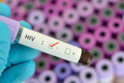 HIV negativ