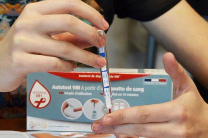 Anwendung des HIV-Selbsttest